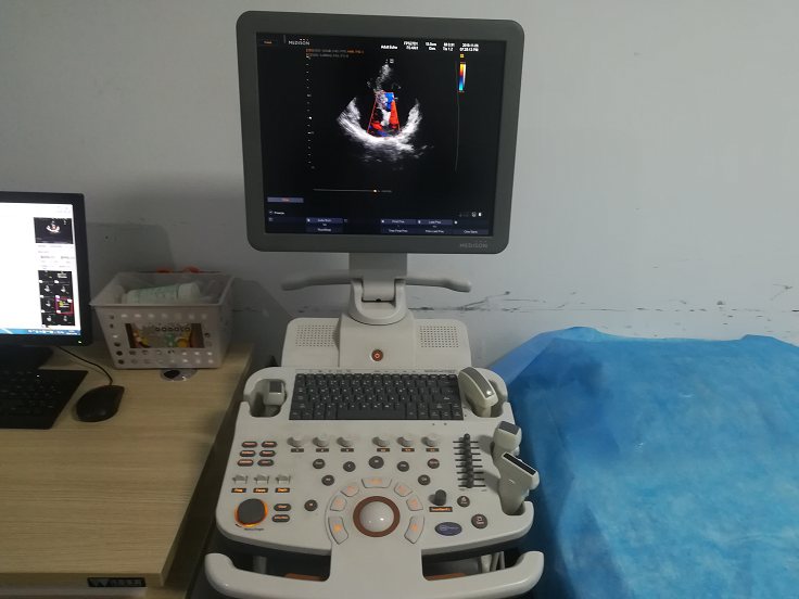 1576735107191933.png 超声1.png