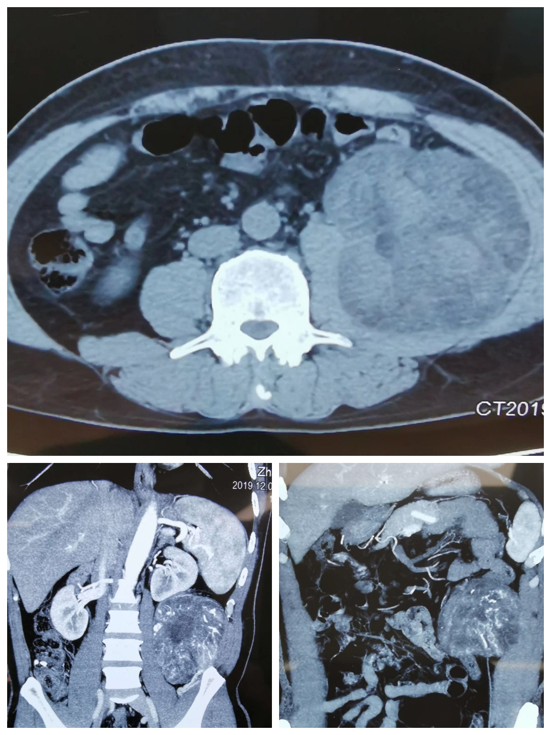 1577180263682278.jpg 1577180263682278.jpg