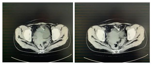 1600938089806666.png image.png