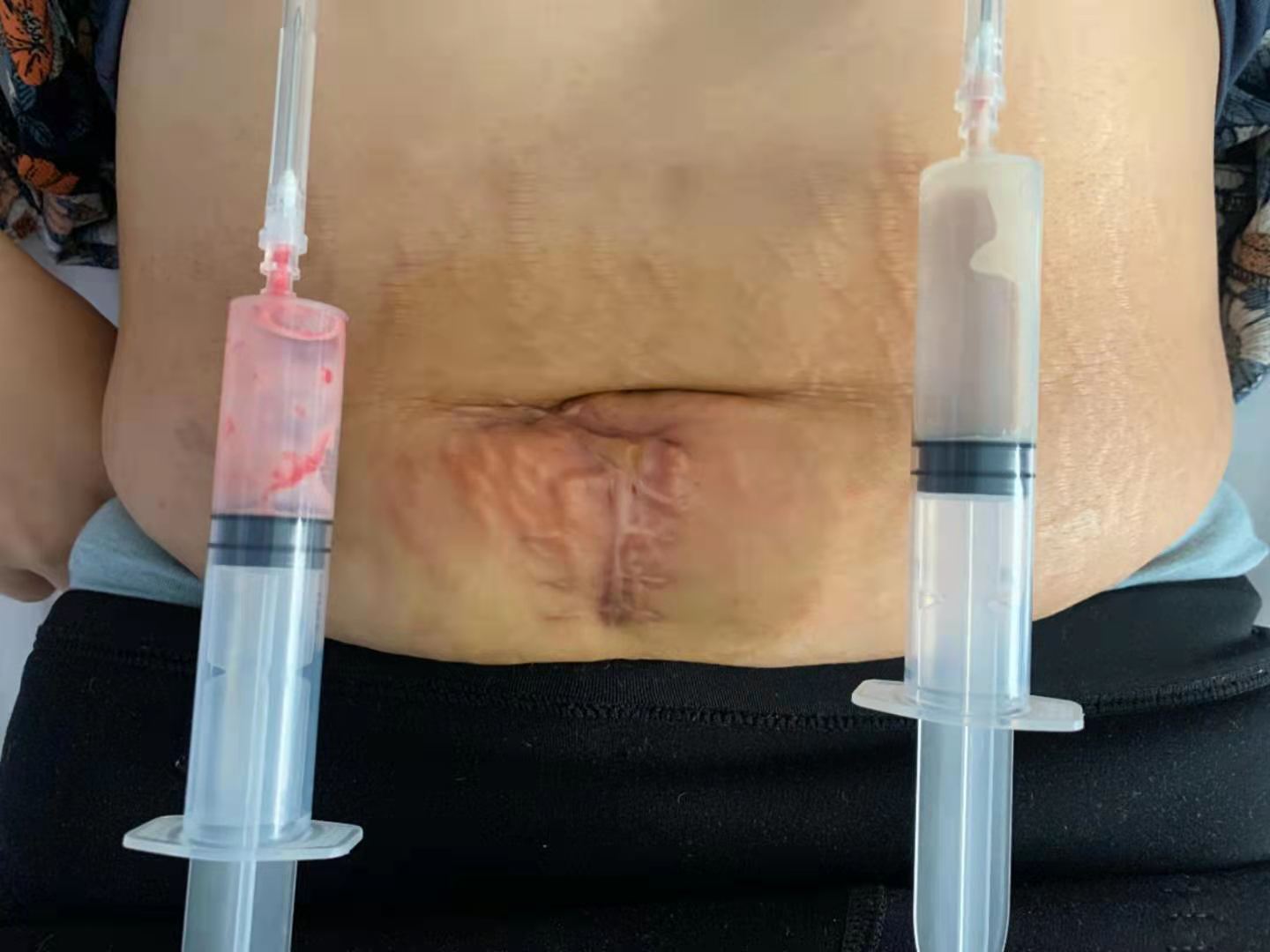 1617261154439071.jpg 1111.jpg