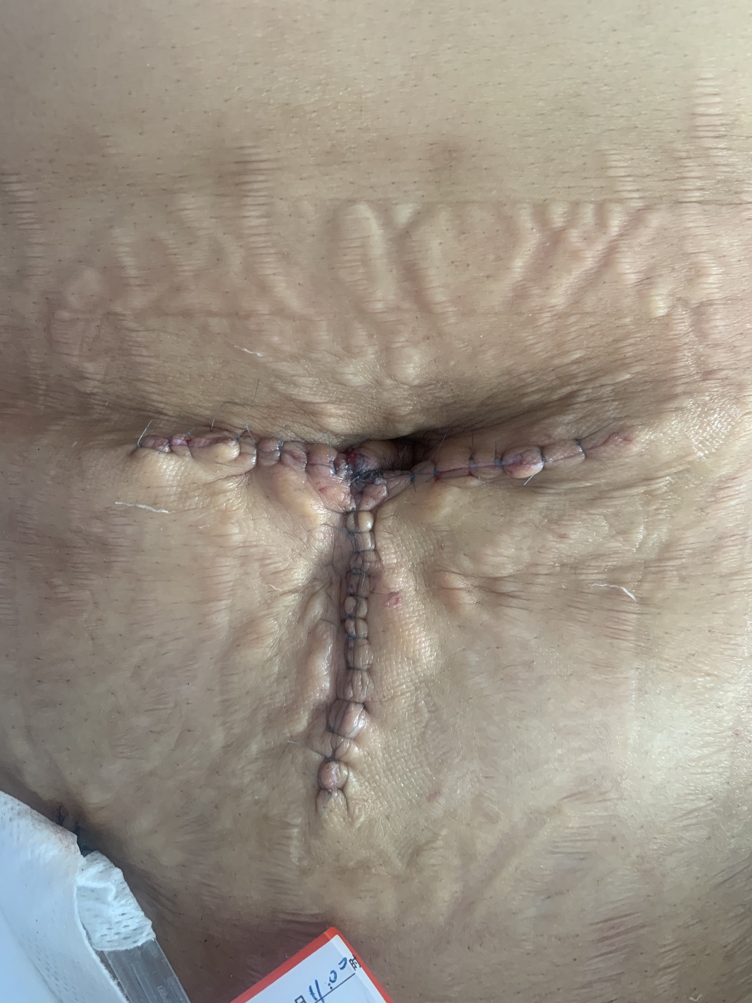 1617261362938267.jpg 5555.jpg