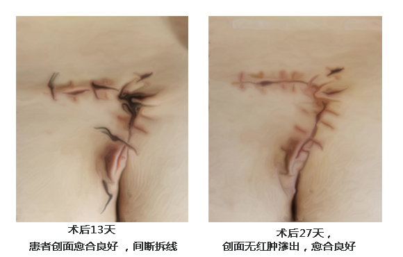 1632921847857906.jpg 45-5.jpg