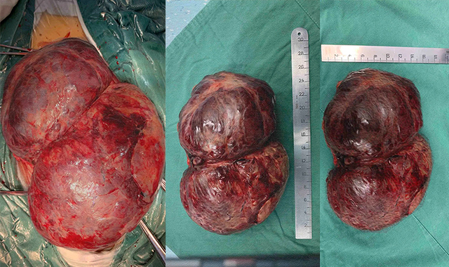 1660632374170734.jpg 58689.jpg