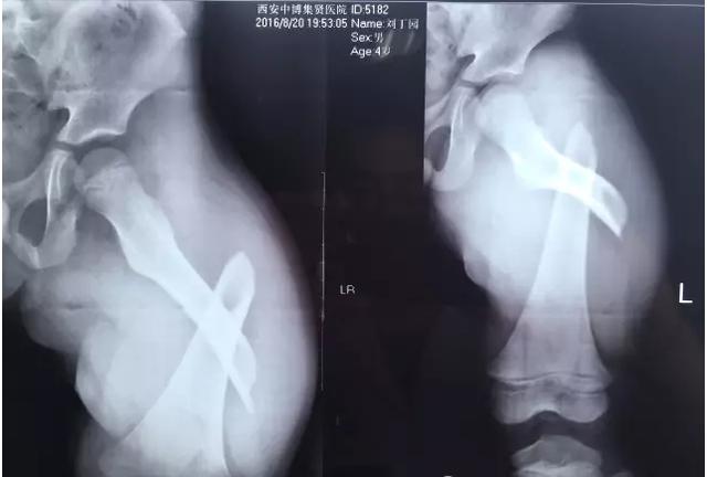 1758357236412571.jpg e154002750821088-37dc5468319bfb35-375b8bdf44840b9c05861f7554e68cf7.jpg