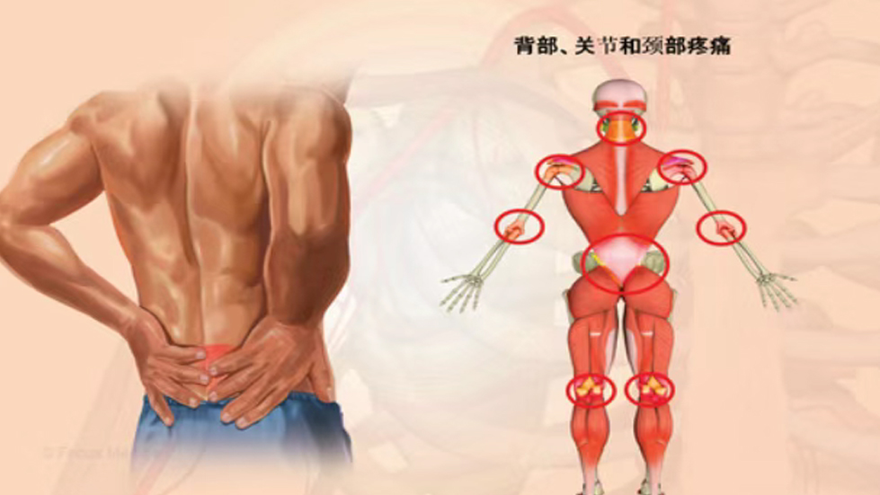 秀人网
康复医学科门诊特色手法技术介绍——意大利筋膜手法