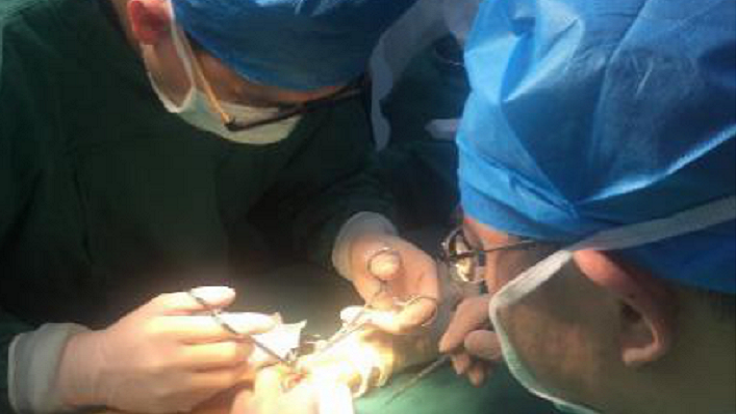 秀人网
开展首例透析患者自体动静脉内瘘成形术