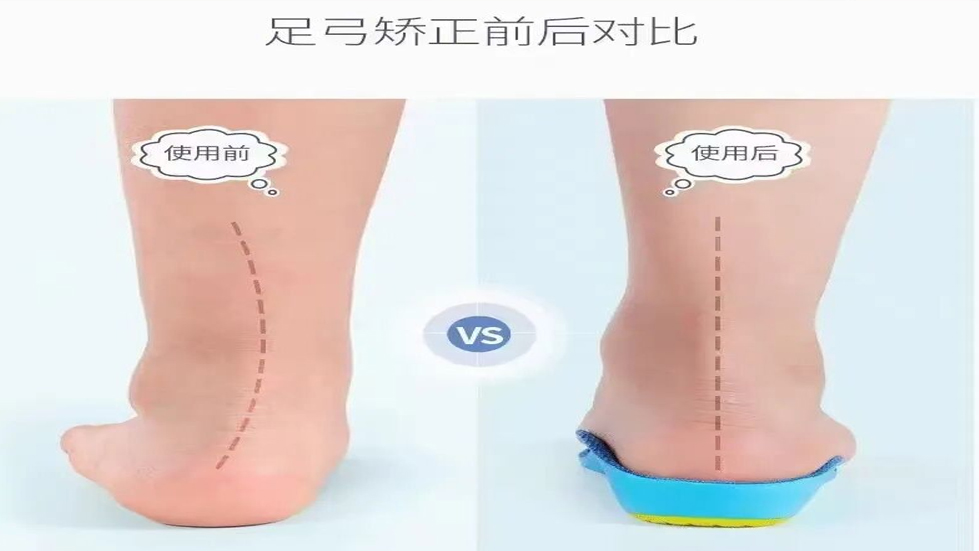 2025通用环球秀人网
脊柱健康夏令营集训活动来袭！不良体态及脊